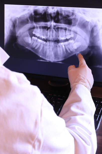 Best Emergency Cosmetic Dentistry in Rochester, NY
